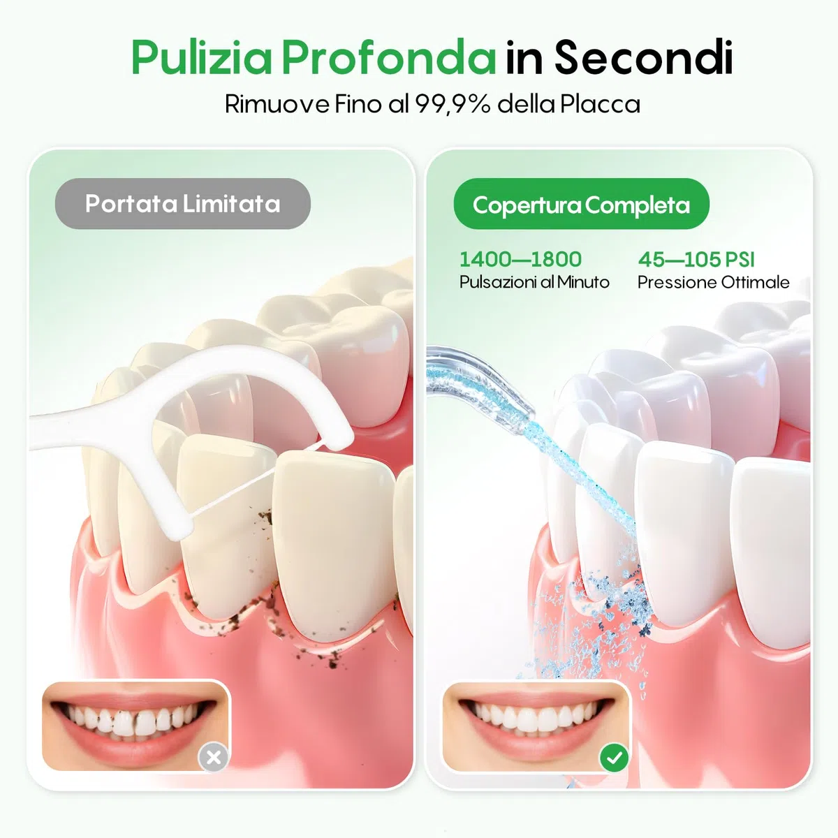 FRESKO Idropulsore Dentale Portatile, 300ML Irrigatore Orale con 4 Modalità 45-105PSI, Batteria 2600mAh, Impermeabile IPX7, 5 Punte per Apparecchi e Impianti