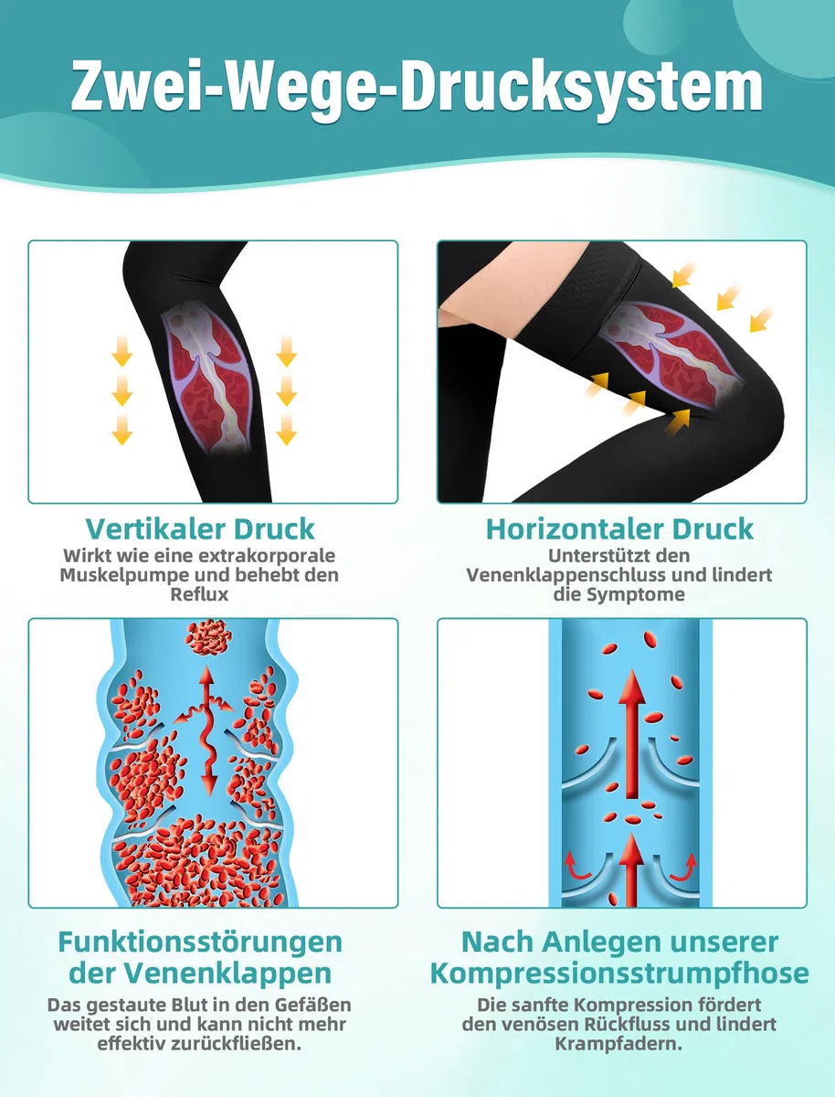 Calze a compressione mediche da donna e da uomo, 15 – 20 mmHg, classe I coscia, calze a compressione lunghe, calze di sostegno senza piedi, con fascia in silicone per supporto graduato vene