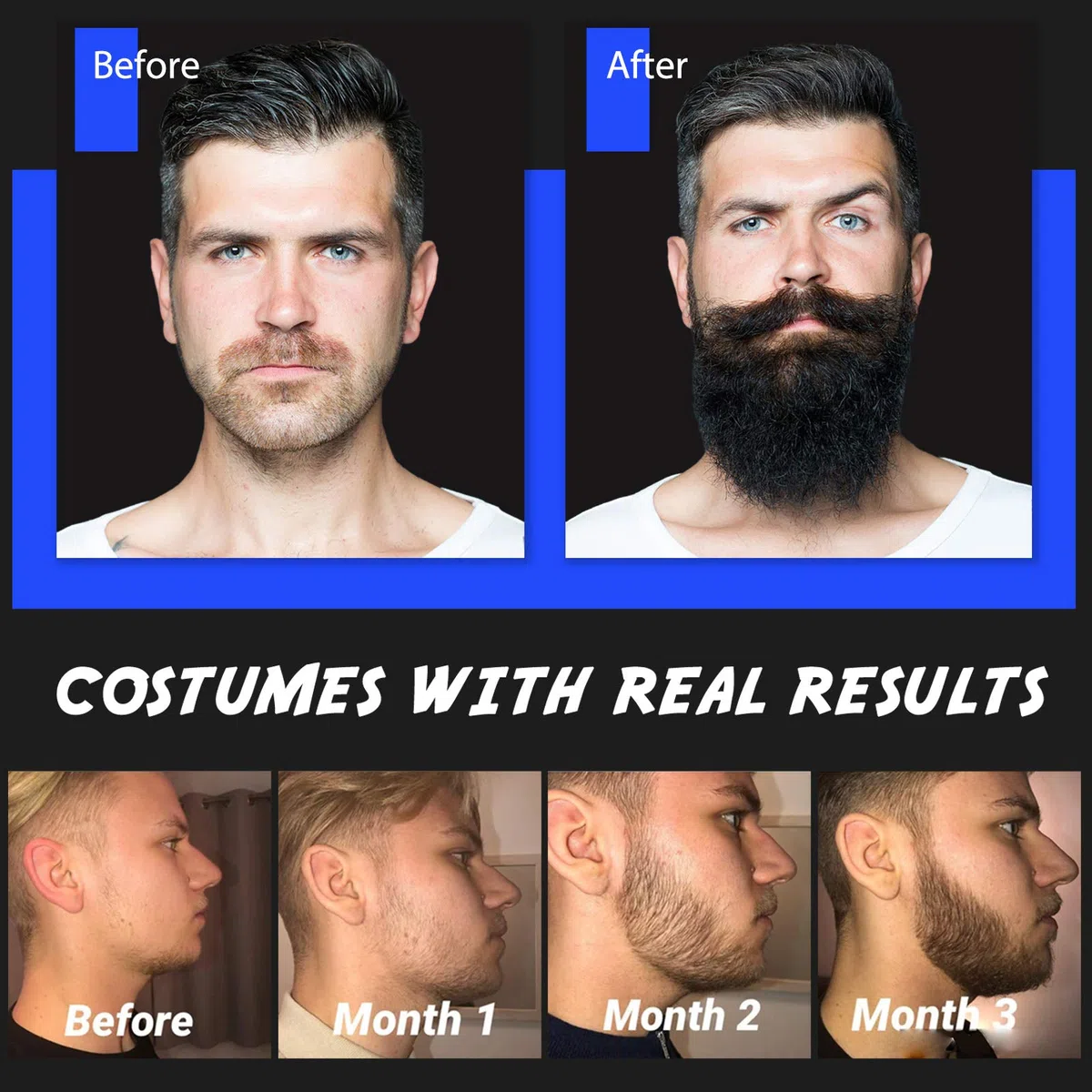 Kit per la Crescita Della Barba, Scdom Kit per la Crescita Della Barba da Uomo con Derma Roller+Olio Siero per la Crescita Della Barba+Balsamo per la Barba+Sapone per la Pulizia Della Barba+Pettine