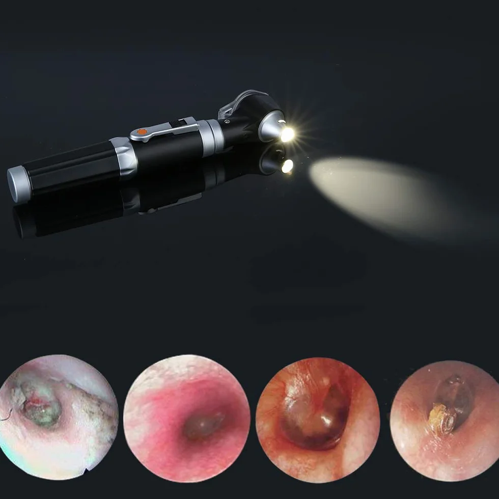 Mini otoscopio, Bysameyee Ingrandimento Otoscopio diagnostico con illuminazione a LED diretta, strumento per l'orecchio sano per i medici Infermieri Adulti Bambini Baby Elder Animali