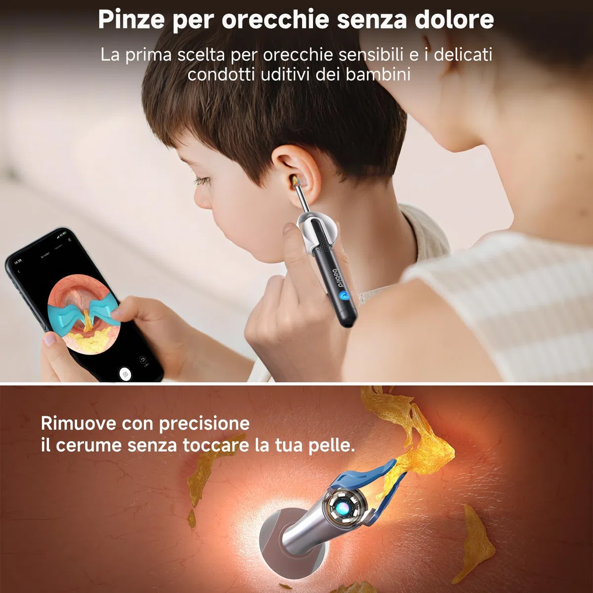 Bebird Otoscopio Digitale, 1920P HD Flessibile Pulisci Orecchie con Telecamera, Kit Rimozione Cerumeper Orecchie/Naso/Gola, Pulizia Orecchie con Pinzette, Punte Sostituibili per Adulti e Bambini
