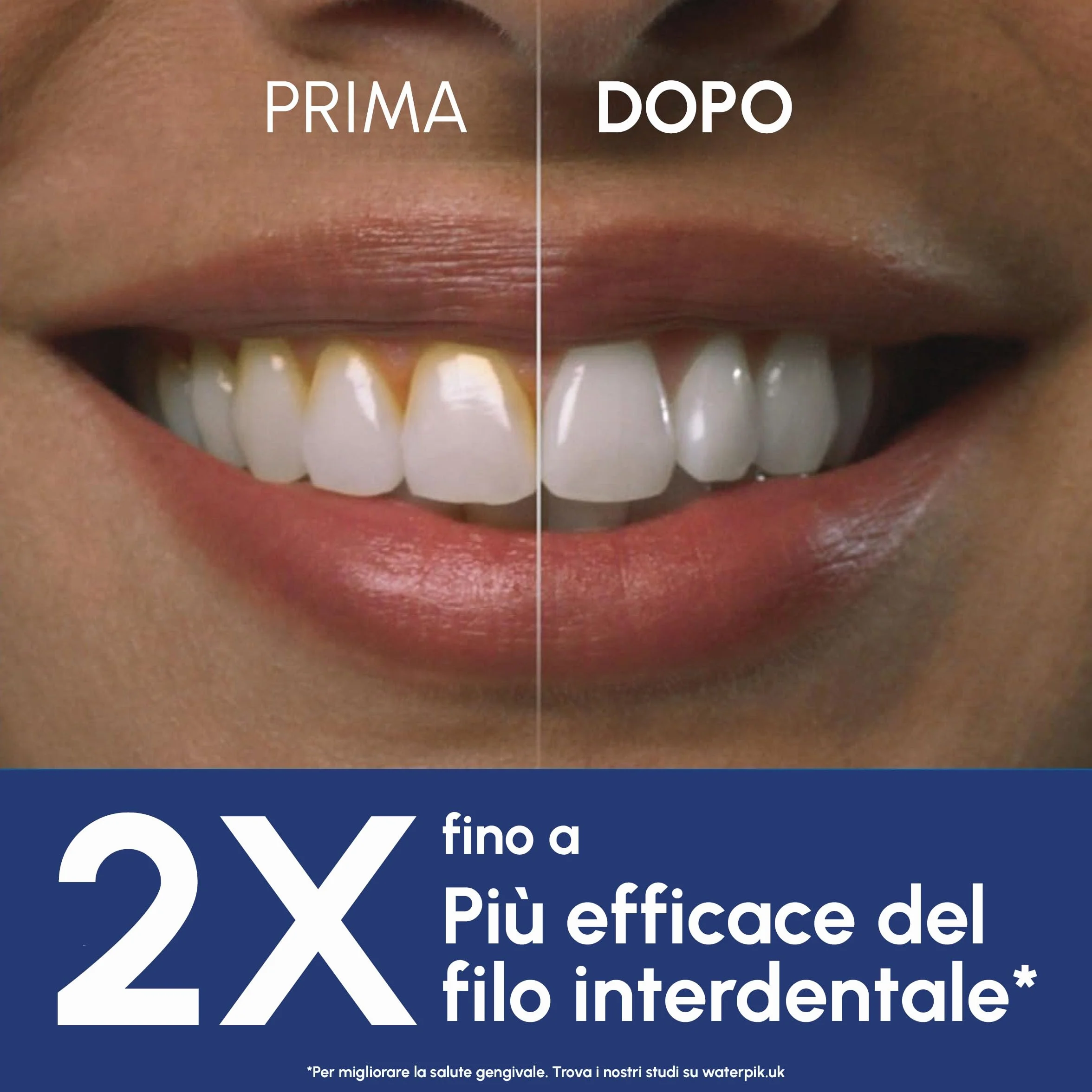 Idropulsore cordless Waterpik Pulse, approvato dalla Oral Health Foundation, idropulsore antiplacca per denti, 2 impostazioni di pressione, 45 secondi di pulizia interdentale, 2 punte incluse