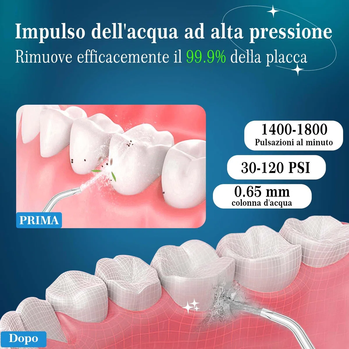 SURFOU Idropulsore Dentale Portatile 3 Modalità 5 Pressione dell'acqua e 7 Ugelli, 230 ml IPX7 Impermeabile USB Ricaricabile per Viaggi e uso Domestico