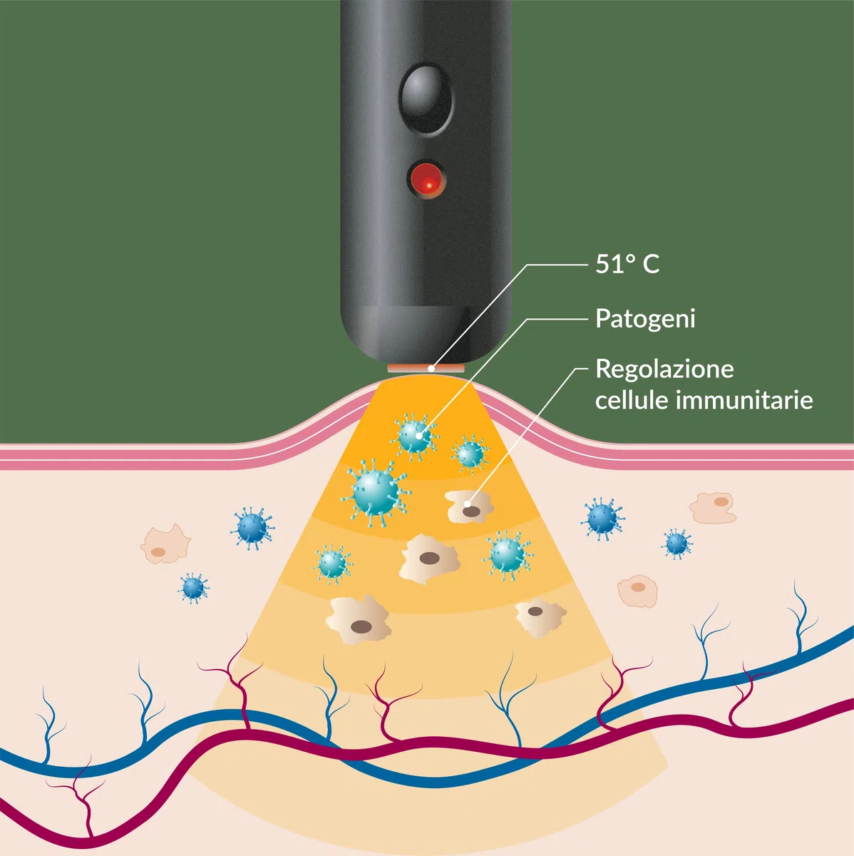 Herpotherm – dispositivo medico contro l’Herpes Labiale – senza sostanze chimiche