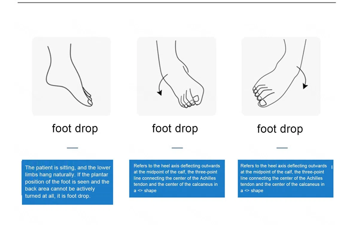 VIDECOR AFO Foot Drop Tutore Medico Foot Up Caviglia Piede Ortesi Supporto per Emiplegia Ictus, Tutore Leggero per Piede Cadente per Camminare Meglio,Left-L