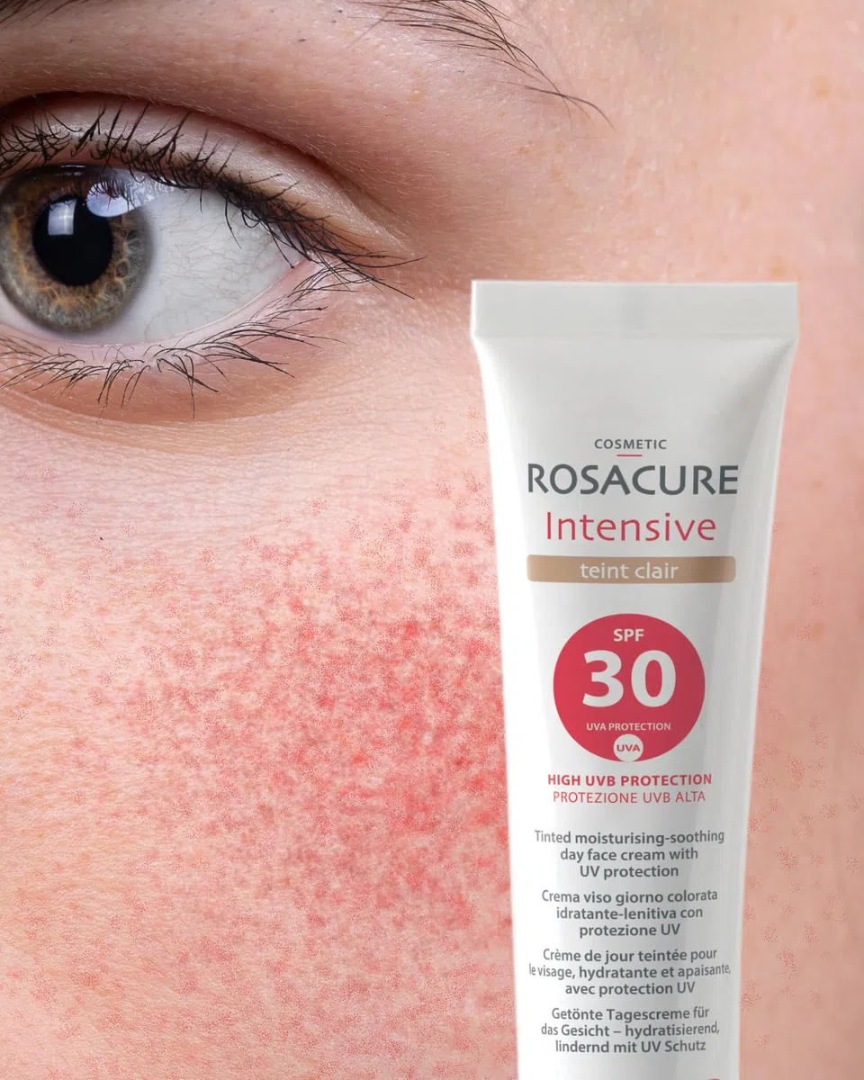 Synchroline - Rosacure Intensive Teint Spf 30 – Crema Viso Colorata Anti-Rossori Effetto Lenitivo 30 Ml, Made In Italy