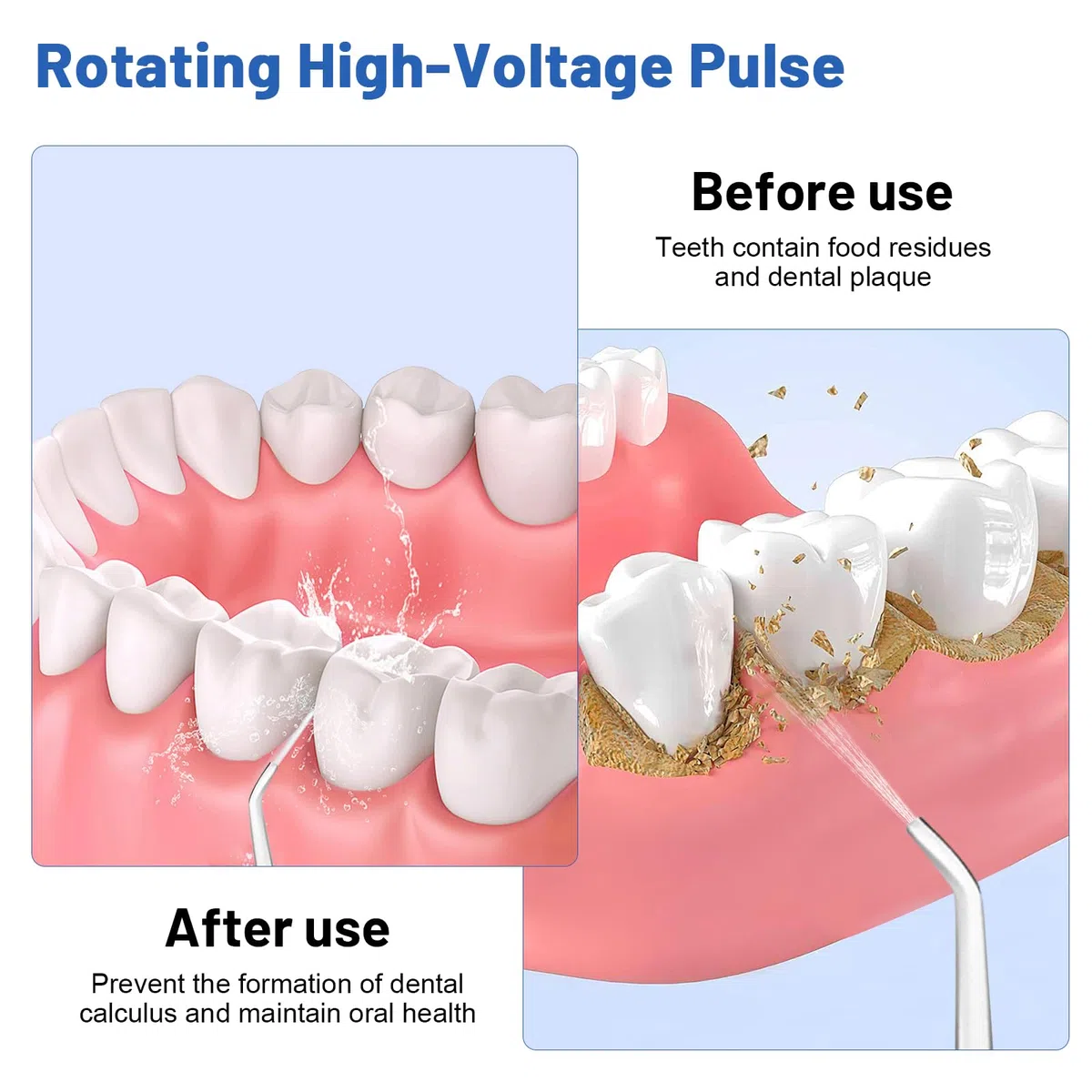 Idropulsore Dentale Oral,Irrigatore Orale,Idropulsore Dentale Portatile,Elettrico Oral Water,con 5 Modalità e 6 Beccucci,Serbatoio da 380ml,Impermeabile IPX7,per Uso Domestico e Viaggi(Nero)