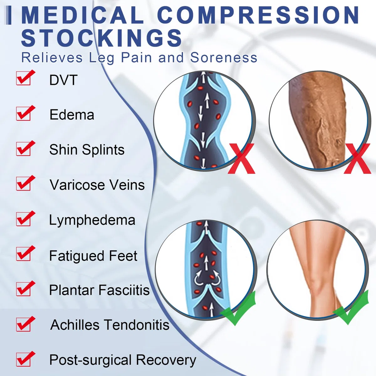 Beister Medical - Calze a compressione a punta chiusa, con fascia in silicone, per donne e uomini, 20-30 mmHg, supporto graduato per vene varicose, edema, volo