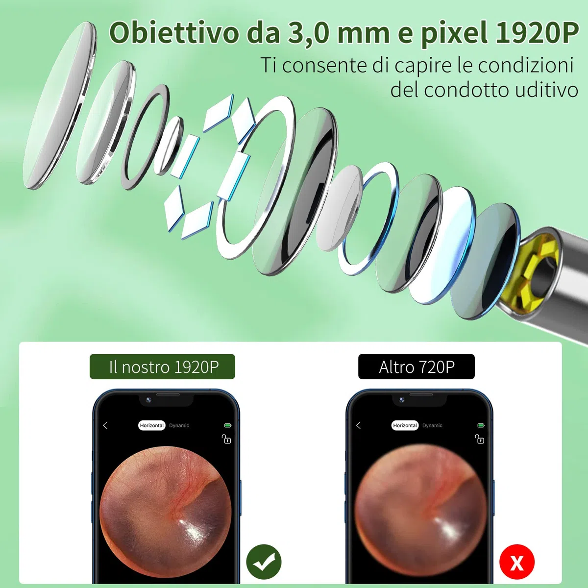 Pulizia Orecchie Otoscopio, 1920P HD Pulisci Orecchie con 6 LED, 3.5mm Pulitore Orecchie, Pulisci Orecchie per iPhone, iPad e Smartphone Android, Bianco