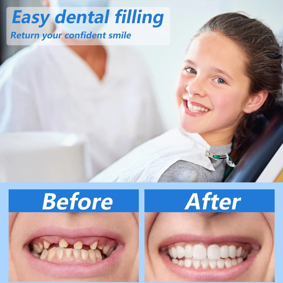 GXGM 100g Cemento per Denti Perline Temporanee di Riparazione dei Denti,Kit Riparazione Denti,Materiale di Riempimento Dei Denti Dental per Otturazioni,Cavità e Denti Scheggiati