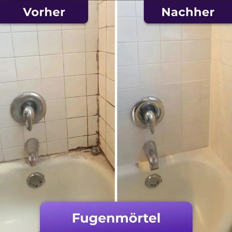 Nuroclean Mold Remover Gel(1 Stück)