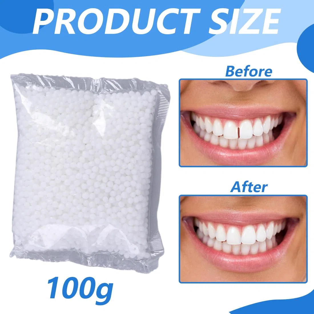 GXGM 100g Cemento per Denti Perline Temporanee di Riparazione dei Denti,Kit Riparazione Denti,Materiale di Riempimento Dei Denti Dental per Otturazioni,Cavità e Denti Scheggiati