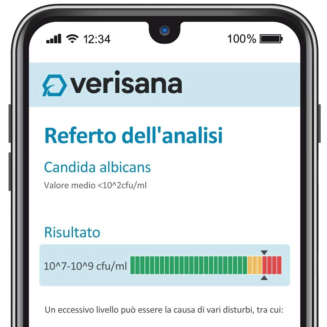 Test per Candida Verisana | Test delle feci + tampone linguale per rilevazione Candida albicans, Candida spec, Geotrichum candidum, muffe | Test per infezioni fungine in feci e cavo orale.