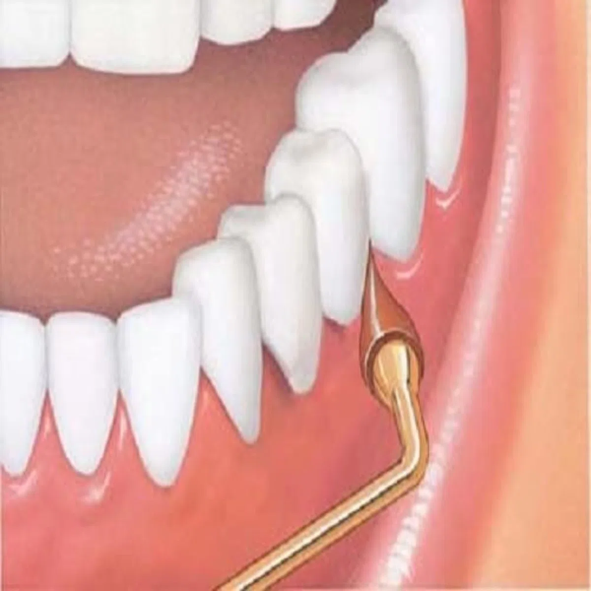 GUM Pacchetto stimolatore, manico permanente con punta in gomma per massaggiare e rinforzare e 2 confezioni di ricarica, (manico + 2 confezioni di ricarica)