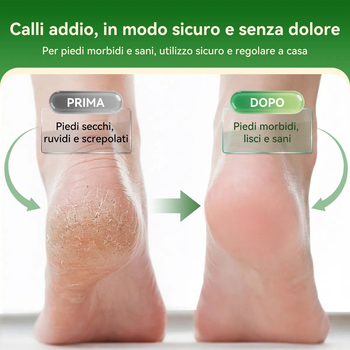 SHORAN Pedicure Elettrico Professionale Piedi, Rimuovi Duroni e Calli Piedi Rimozione Ricaricabile per Eliminare Gratta Togli Leviga Cura Pelle morta e Talloni screpolati, con 3 Rulli e 2 Raspa Piedi