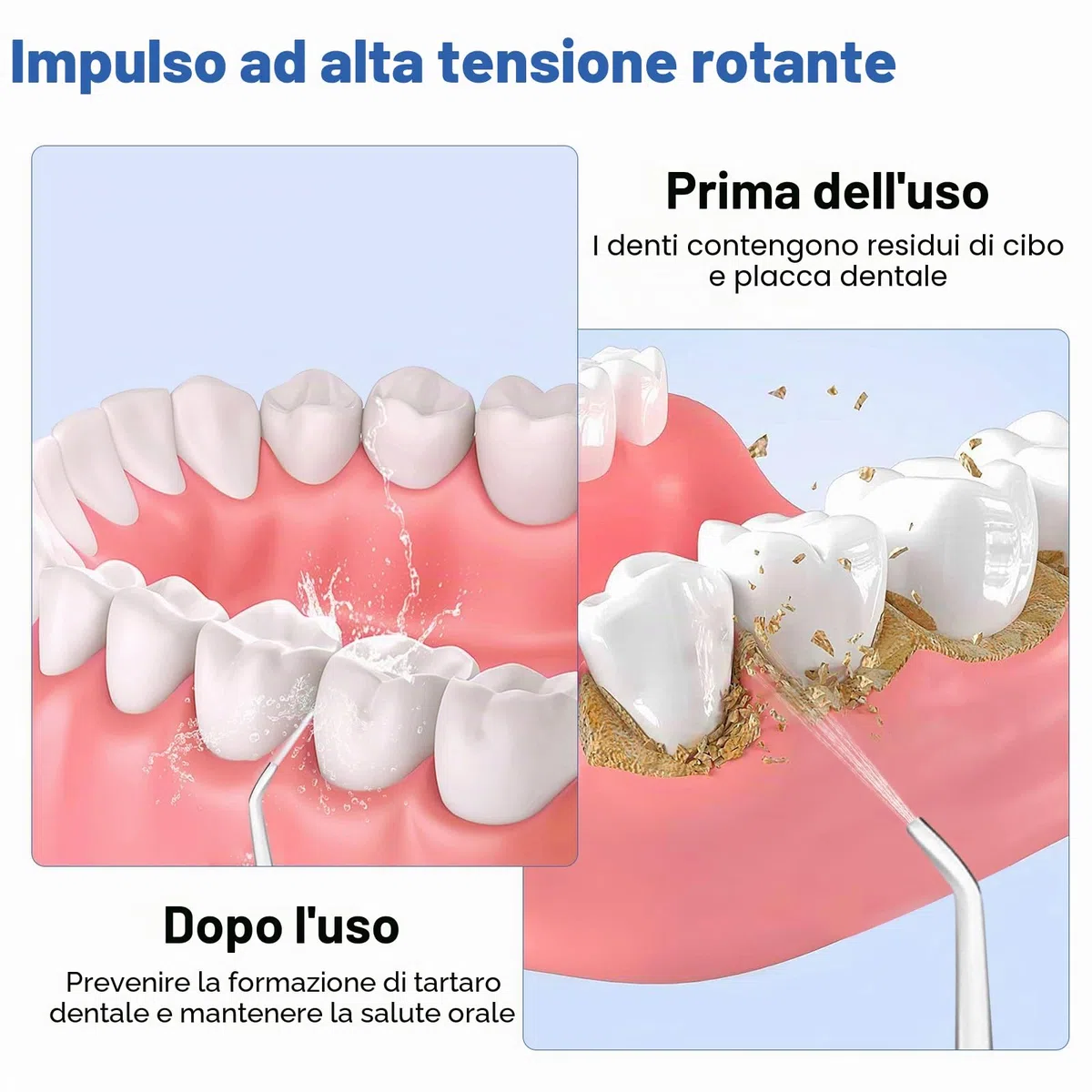 Idropulsore Dentale Oral,Irrigatore Orale,Idropulsore Dentale Portatile,Elettrico Oral Water,con 5 Modalità e 6 Beccucci,Serbatoio da 380ml,Impermeabile IPX7,per Uso Domestico e Viaggi(Bianco)