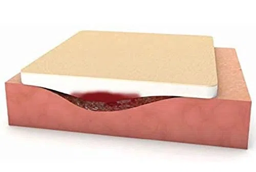 Medicazione in schiuma PU, non adesiva per ferite da moderatamente a fortemente essudanti 10x10cm