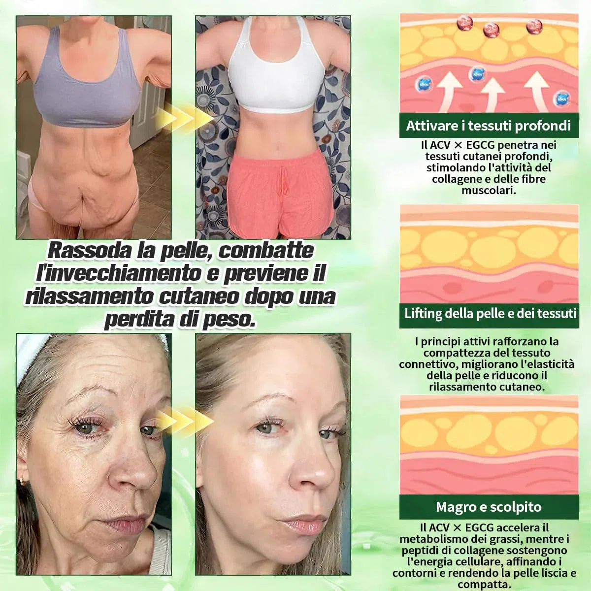 Purelora ACV x EGCG Patch Avanzato Nano Microneedle 10-in-1, Naturali Cerotti Dimagranti Efficaci, Purelora Moringa Cerotti, per Addome, Braccia e Gambe (2 Scatole)