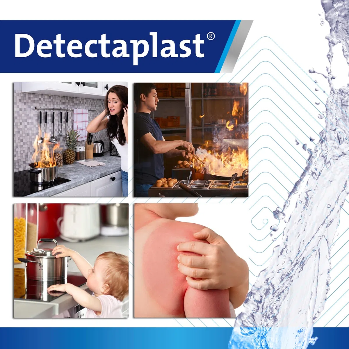 Detectaplast Gel bruciante per ustione (118 ml, 2 pezzi) – idrogel unguento antincendio – gel rinfrescante a base d'acqua