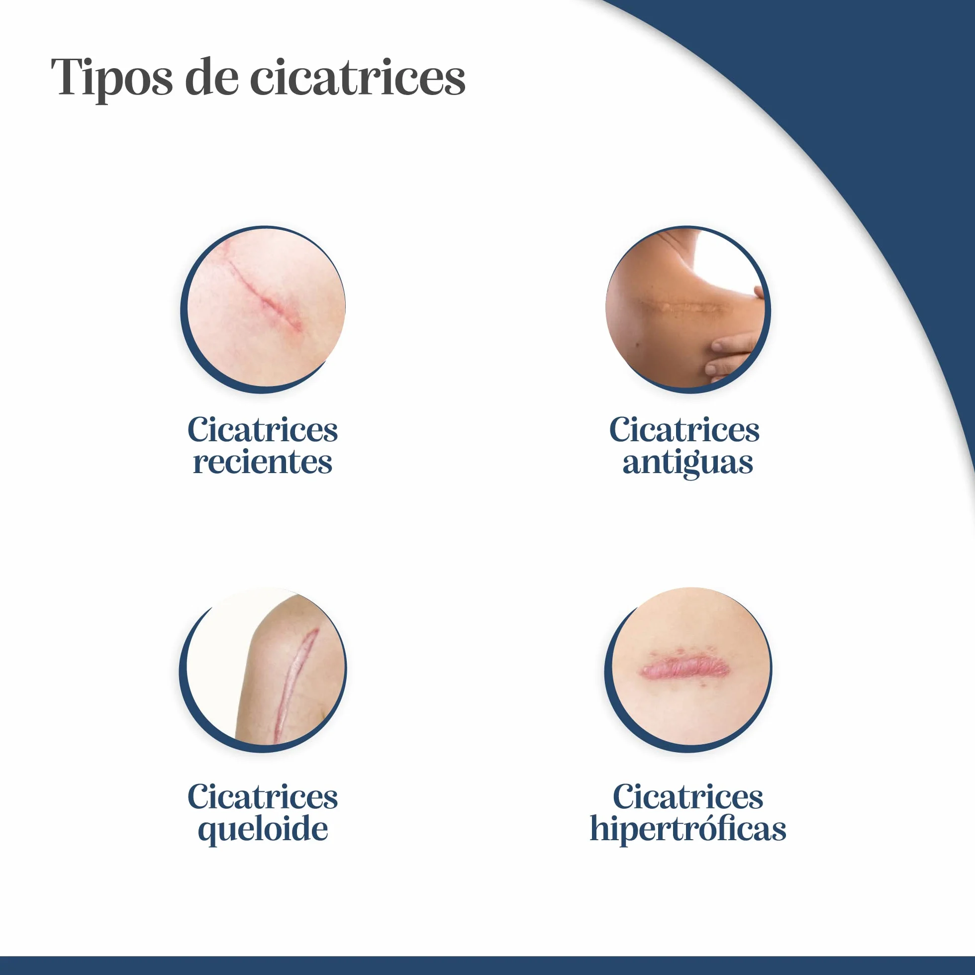 Trofolastin Reduc Cicatriz 5X7,5Cm 5Apos