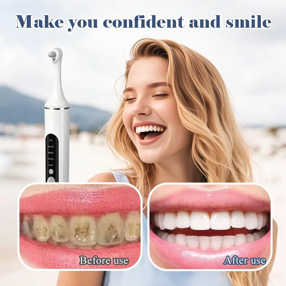 Rimozione del tartaro con 5 teste, lucidatore dentale, set professionale con 5 modalità di pulizia dei denti e sbiancamento dei denti, per lucidare dopo la pulizia dei denti (bianco)