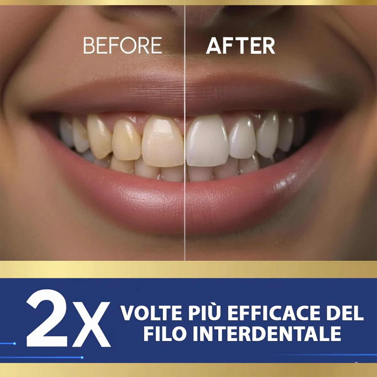 Idropulsore Dentale Portatile DENTAL V-PRO da 300ml. Idropulsore denti,alta pressione con 5 ugelli +1 specchio per pulizia denti profonda. Water flosser Impermeabile. Irrigatore Orale pulizia profonda