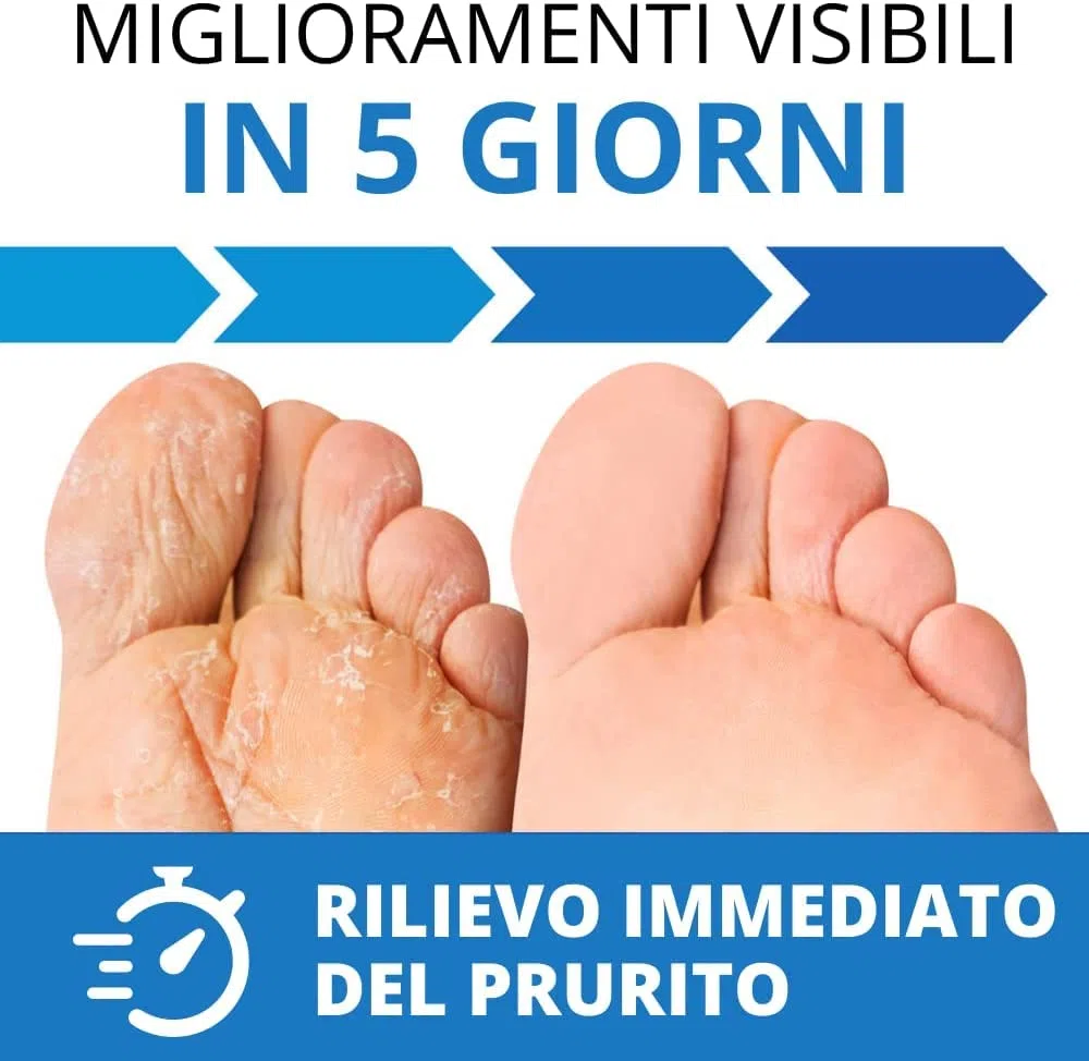 Trattamento del piede dell'atleta | Crema antifungino e anti tigna, Extra Large 75 ML | Il più venduto negli Stati Uniti